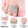 thumbnail image 3 of Toe Straighteners for Hammer Toes, Broken Toes, Crooked Toes, Overlapping Toes (8-Pack), 3 of 5