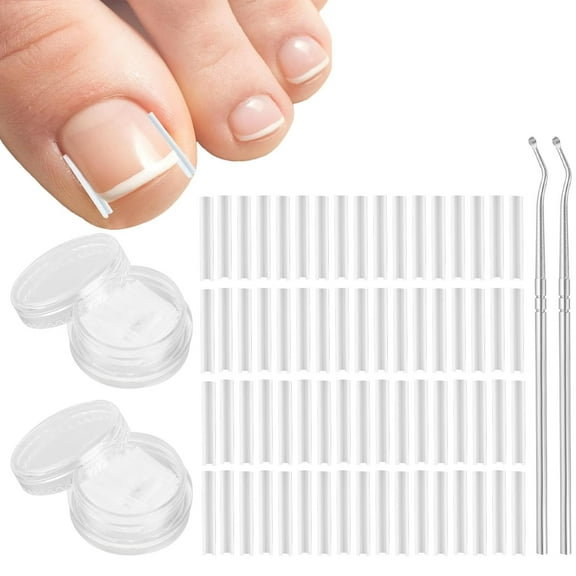 Ingrown Toenail Corrector Treatment Set,Bexikou 102 Pcs Ingrown Toenail Correction Strips Brace Kit, Ingrown Toenail Corrector, Toenail Straightener Strips with Nail Clipper for Women Men Foot Care
