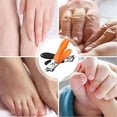 thumbnail image 5 of Payemphasize Clippers,Peachloft Oblique Nail Clippers,Wide Jaw Opening Anti-Splash Slanted Nail Clipper,Slanted Nail Clippers-No Splash Nail Trimmer (Black+Orange*2), 5 of 6