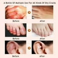 thumbnail image 2 of CNKOO 30g Cracked Heel Balm Cream For Rough Dry Feet Skin Moisturizing Foot for Skin Care, 2 of 12