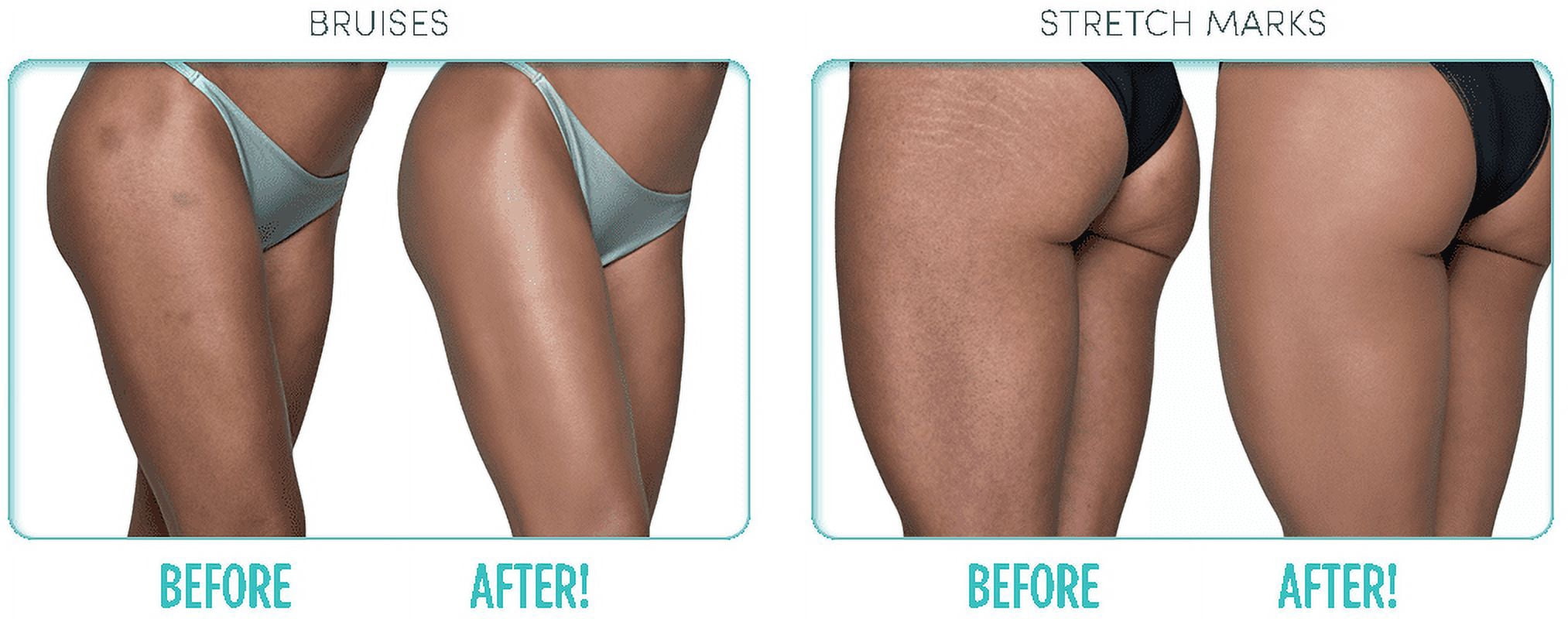 Ideal Conceal Light to Medium Instant Body Enhancer As Seen On Tv