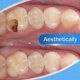 thumbnail image 4 of Teeth Resin Tooth Repair Dental Cement Cavity Filling Strong Repair Restoration, 4 of 4