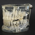 thumbnail image 3 of Modelo de enseñanza de estudio de dientes modelo de dientes modelos de dientes dentales modelo de enfermedad periodontal para enseñanza de laboratorio ANGGREK Otros, 3 of 8