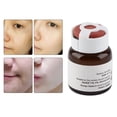 thumbnail image 1 of Solución de Cuidado de la Piel, Manchas Suaves Portátiles Suero Desvanecido, Prácico para Mujeres Niñas, 1 of 7