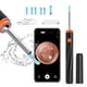 thumbnail image 3 of Methold Equipo de eliminación de cerumen, accesorios de limpieza de oídos para el hogar, Kit de extracción de dispositivo de para cámara Electrónica Negro, 3 of 6