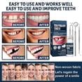 thumbnail image 4 of Temporary Tooth Repair Kit Fix Broken Teeth Fills Gaps Dental Denture Damage, 4 of 4