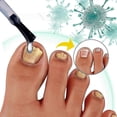 thumbnail image 2 of Toenail Repair Liquid Nail Fungus Hand And Foot Nail Bump, 2 of 5