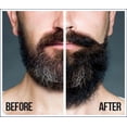 thumbnail image 4 of Aceite natural para cabello y barba SFC Natural King Pro-Growth 210 ml, 4 of 9