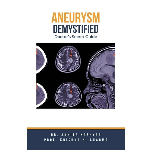 Aneurysm Demystified: Doctor's Secret Guide, (Paperback)