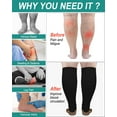 thumbnail image 2 of 2 Pairs Medical Sport Open Toe Compression Socks - 20-30mmhg Graduated Knee-High Support for Men & Women, Ideal for Soccer, Running, and Nurses, 2 of 8