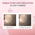 thumbnail image 2 of SKIN1004 Madagascar Centella Poremizing Fresh Ampoule, 2 of 6