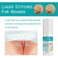 thumbnail image 3 of SharkTRUE Liquid Bandage Spray 30ml, Waterproof Spray Plasters Healing Gel Liquid, 3 of 8
