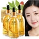 thumbnail image 1 of Esencia Facial de Ginseng Gold Polypeptide JitEm para Reducir Líneas Finas y Reafirmar Piel Flácida, 1 of 6