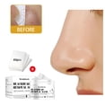 thumbnail image 1 of Mascarilla removedora de espinillas 30ml limpieza profunda Unisex purificante poro acné cara tiras para mejillas piel grasa todo tipo Yinane Eliminación de puntos negros, 1 of 8