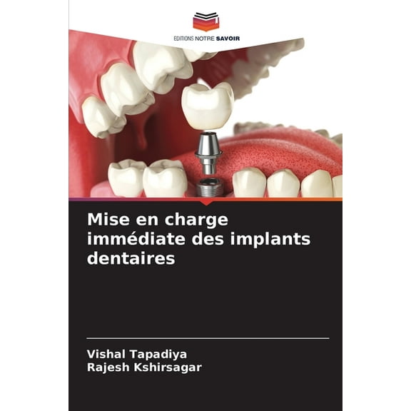 Mise en charge immédiate des implants dentaires, (Paperback)