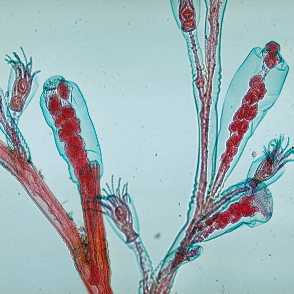 Obelia Prepared Microscope Slide, Whole Mount - Walmart.com