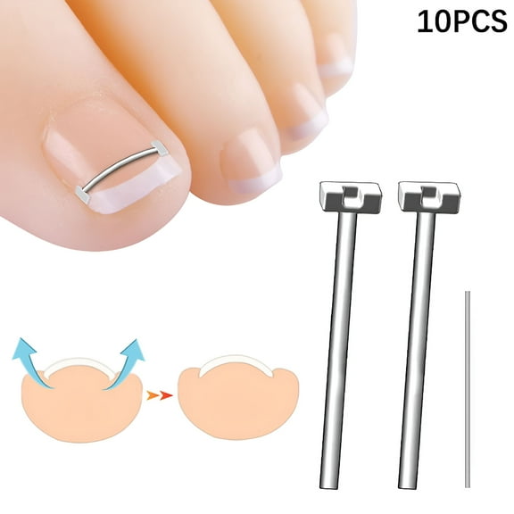 XIRQI Ingrown Toenail Corrector Tools Pedicure Recover Embed Toe Nail Treatment Professional Ingrown Toenail Correction Foot Care Tool
