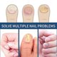 thumbnail image 2 of 96pcs Anti Fungal Nail Treatment-toe-fungus Onychomycosis Repair Sticker, 2 of 5