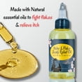 thumbnail image 3 of Dry, Itchy & Flaky Scalp Relief Oil – Natural Leave-In Treatment for Dry, 2 oz - by LatherGreen, 3 of 15