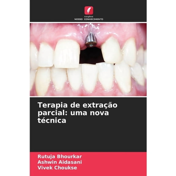 Terapia de extraÃ§Ã£o parcial: uma nova tÃ©cnica, (Paperback)