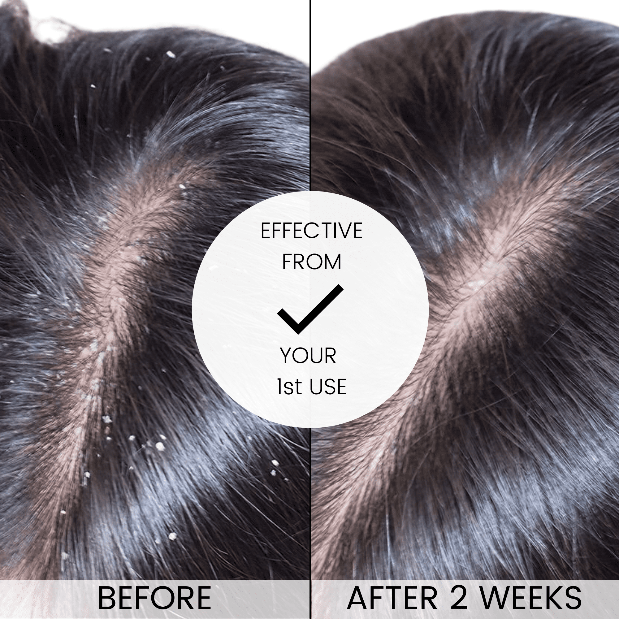 Buy Alevai Stem Cell Anti Dandruff Conditioner for Women & Men, Itchy