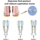thumbnail image 3 of Plantillas de supinación para un soporte de arco alto con sobresupinación, plantillas ortopédicas para hombres y mujeres, soportes correctivos para los pies para aliviar la supinación, 3 of 4