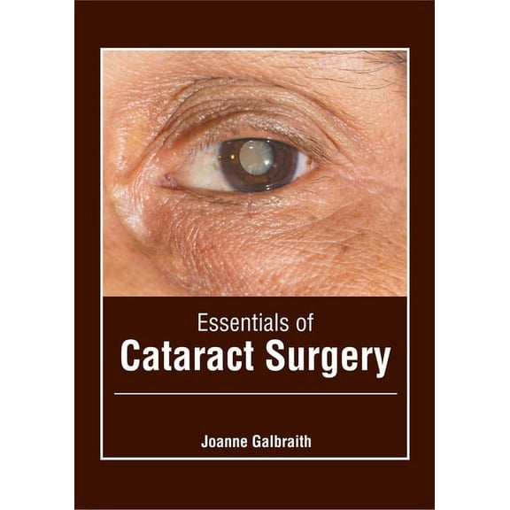 Essentials of Cataract Surgery, (Hardcover)
