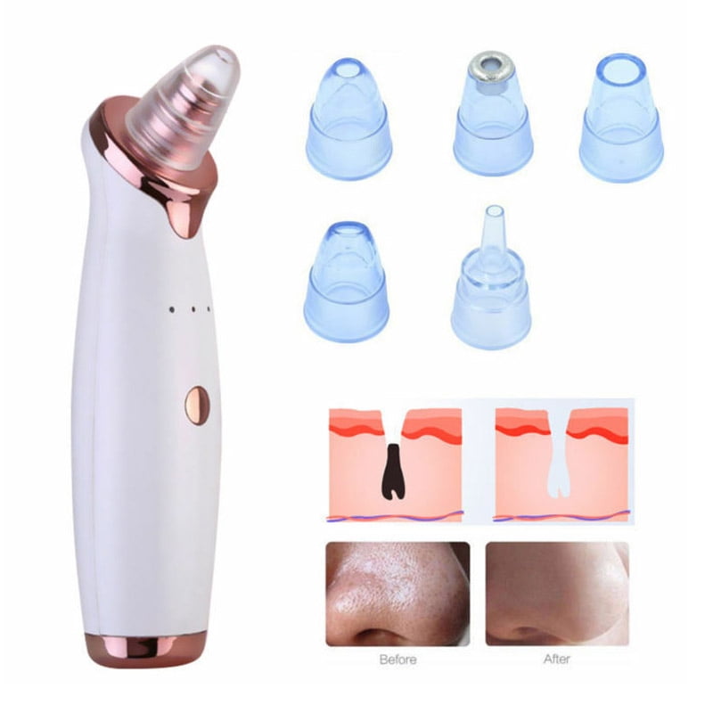 Blackhead Remover Vacuum,Electric Blackhead Vacuum Cleaners,Whitehead