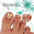thumbnail image 3 of 3pcs Kerassentials For Toenail Fungus, Kerassentials Toenail Fungus Treatment Oil, 3 of 5
