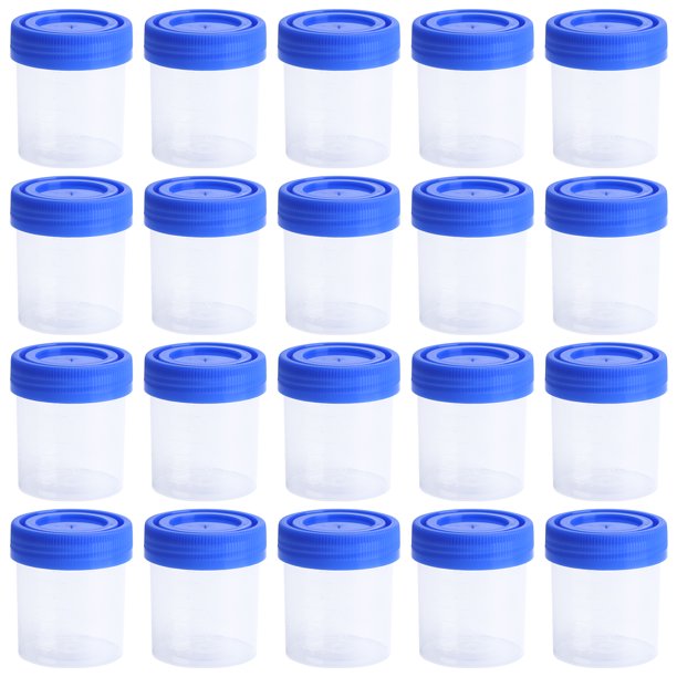 NUOLUX Cups Specimen Urine Lids Screw Sterile 100 Sample Party
