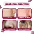 thumbnail image 3 of Suero facial ácido de frutas de 30ml, ácido salicílico, esencia para reducir los poros, piel Ygjytge Cuidado Belleza, 3 of 8