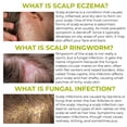 thumbnail image 3 of Champú antifúngico para la foliculitis para la dermatitis seborreica, la psoriasis del cuero cabelludo, la caspa y la picazón del cuero cabelludo seco, 3 of 5
