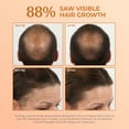 thumbnail image 3 of Bosley MD Revive Color Safe Starter Kit - Shampoo, Conditioner and Thickening Treatment, 3 of 7