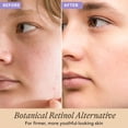 thumbnail image 2 of Beauty by Earth - YouthRestoration Bakuchiol Face Serum, 2 of 7