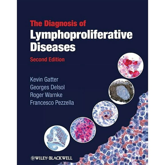The Diagnosis of Lymphoproliferative Diseases (Hardcover)