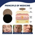 thumbnail image 4 of Nerve Healing Patch, 4 of 4