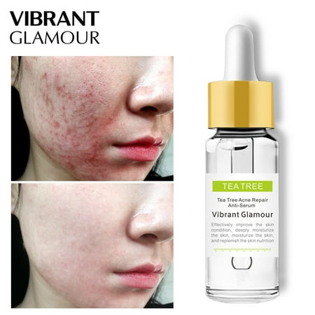VIBRANT GLAMOUR Tea Tree Acne Repair Face Serum Scar Acne Treatment Oil Control (Best Acne Scar Lightening Treatment)