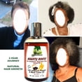thumbnail image 5 of Fountain Mighty Roots Jamaican Pimento Hair Loss & Regrowth Treatment, 4 Fl Oz, 1 Piece Bundle, 5 of 5