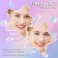 thumbnail image 3 of Kit de pegatinas desechables para el acné con parche para el acné, 84 Uds., para puesta en escena Ygjytge Cuidado Belleza, 3 of 7