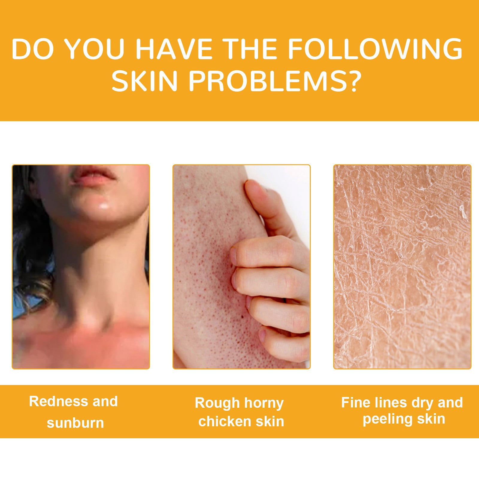 Complete Skin Solutions Copper Peptide The Buffet Even Tone Super Glow for Your Face Skin Recovery All Care for Oily Skin Hyper Skin Hyper Boreal 1st C Happy Life Korean for Glowing Skin Sweat