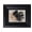 Abstract Flower, variant on Postrame-Black Framed Modern Fruit Picture Print Wall Art-For Dining Room&More-10×10Inch