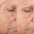 thumbnail image 4 of Inicio Kit de microdermoabrasión PMD Microderm Classic para rostro, 4 of 9