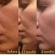 thumbnail image 4 of Crema de noche Derma Detox Rejuvenecedora con Retinol 30 ml, 4 of 8
