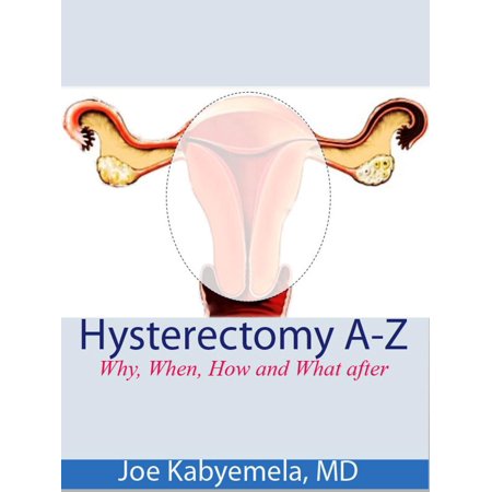 Hysterectomy A-Z: Why, When, How and What after - (Best Lubricant After Hysterectomy)