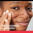 thumbnail image 3 of Limpiador facial Neutrogena Stubborn Texture con ácido salicílico 180 ml, 3 of 5