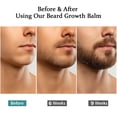 thumbnail image 4 of Bálsamo estimulante para barba Vbolre Ultra Potent Growth 100 ml, 4 of 7