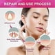 thumbnail image 4 of Mascarilla reparadora para el acné Jaysuing 10 unidades, 4 of 5