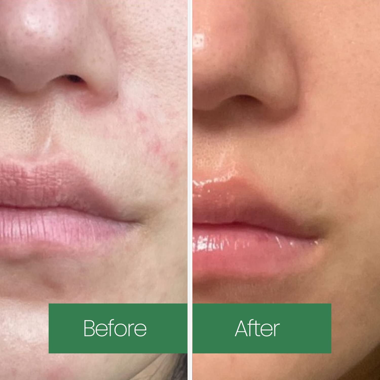 Lapalette Beauty - Calming Green Turnover Toner