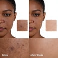 thumbnail image 2 of Grocerism 20% Vitamin C Facial Serum, Brightening Hydrating Skin Care 1 fl oz, 2 of 9