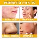 thumbnail image 5 of Hot6sl Ofertas Del Día Cicatrices Eliminables Faciales Naturales 30 Ml, 5 of 7